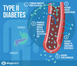What Is Diabetes Mellitus Endocrine System Diseases